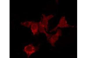 ABIN6278592 staining HuvEc by IF/ICC. (MRGPRX4 Antikörper  (C-Term))