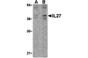 Western Blotting (WB) image for anti-Interleukin 27 (IL27) (N-Term) antibody (ABIN1031413) (IL-27 Antikörper  (N-Term))