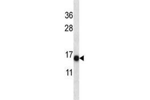 S100A7 antibody western blot analysis in NCI-H292 lysate. (S100A7 Antikörper  (AA 2-31))