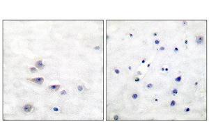 Immunohistochemistry (IHC) image for anti-SHC (Src Homology 2 Domain Containing) Transforming Protein 1 (SHC1) (pTyr427) antibody (ABIN1847217) (SHC1 Antikörper  (pTyr427))