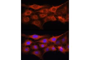 Immunofluorescence analysis of C6 cells using GALNS Rabbit pAb (ABIN6131691, ABIN6140937, ABIN6140938 and ABIN6221120) at dilution of 1:100 (40x lens). (GALNS Antikörper  (AA 353-522))