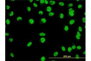 Immunofluorescence of monoclonal antibody to YY1 on HeLa cell.