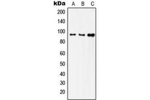 Western blot analysis of Insulin Receptor expression in HeLa (A), SKOV3 (B), HepG2 (C) whole cell lysates. (Insulin Receptor Antikörper  (C-Term))