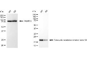 Western blotting analysis using eukaryotic translation initiation factor 5A antibody (ABIN7798534). (Rekombinanter EIF5A Antikörper)