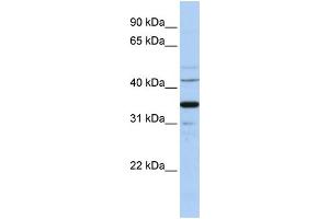 WB Suggested Anti-WNT5A Antibody Titration:  1 ug/ml  Positive Control:  Hela cell lysate WNT5A is strongly supported by BioGPS gene expression data to be expressed in Human HeLa cells (WNT5A Antikörper  (Middle Region))