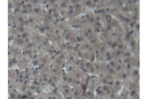 Detection of C3 in Porcine Liver Tissue using Polyclonal Antibody to Complement Component 3 (C3) (C3 Antikörper  (AA 23-300))