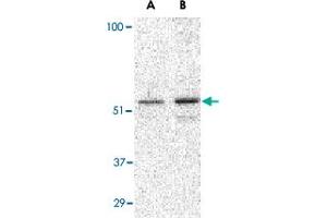 Western blot analysis of PLIN3 in Daudi cell lysate with PLIN3 polyclonal antibody  at (A) 0. (PLIN3 Antikörper  (C-Term))