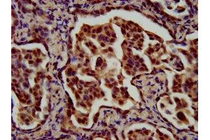 Immunohistochemistry (IHC) image for anti-Regulatory Factor X, 1 (Influences HLA Class II Expression) (RFX1) (AA 36-133) antibody (ABIN7159682)