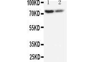 Anti-PMP70 antibody, Western blotting Lane 1: Rat Lung Tissue Lysate Lane 2: Rat Ovary Tissue Lysate (CX3CL1 Antikörper  (C-Term))