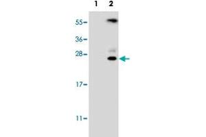 Western blot analysis of KLK6 (arrow) using KLK6 polyclonal antibody . (Kallikrein 6 Antikörper  (N-Term))