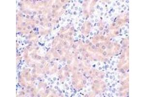 Immunohistochemistry of Bfl-1 in mouse kidney tissue with Bfl-1 antibody at 2 μg/ml. (BCL2A1 Antikörper  (N-Term))