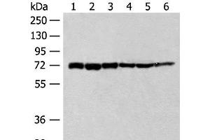 Western blot analysis of 293T cell Human fetal brain tissue Jurkat cell Hela cell Mouse heart tissue lysates using TCF25 Polyclonal Antibody at dilution of 1:250 (TCF25 Antikörper)