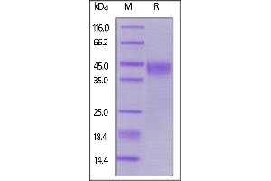 SDS-PAGE (SDS) image for Leukemia Inhibitory Factor (LIF) (AA 23-202) protein (His tag,AVI tag,Biotin) (ABIN5954922)