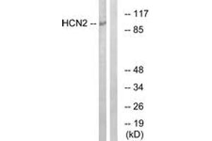 Western blot analysis of extracts from Jurkat cells, using HCN2 Antibody. (HCN2 Antikörper  (AA 491-540))