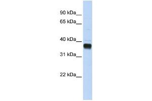 Western Blotting (WB) image for anti-Nudix (Nucleoside Diphosphate Linked Moiety X)-Type Motif 18 (NUDT18) antibody (ABIN2459244) (NUDT18 Antikörper)