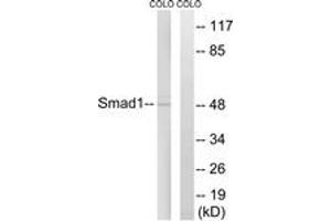 Western blot analysis of extracts from COLO cells, treated with EGF 200ng/ml 30', using Smad1 (Ab-465) Antibody. (SMAD1 Antikörper  (AA 416-465))