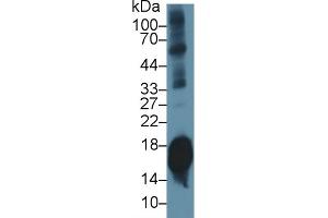Detection of SNCa in Mouse Cerebrum lysate using Polyclonal Antibody to Synuclein Alpha (SNCa) (SNCA Antikörper  (AA 23-140))