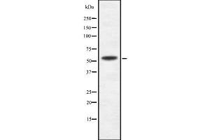 Western blot analysis IFIT1B using COLO205 whole cell lysates