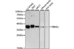 Western blot analysis of extracts of various cell lines, using RBM11 antibody (ABIN6133082, ABIN6146756, ABIN6146757 and ABIN6217133) at 1:3000 dilution. (RBM11 Antikörper  (AA 1-281))