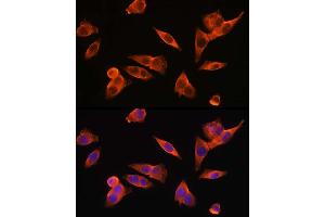 Immunofluorescence analysis of HepG2 cells using TLR4 Rabbit pAb (ABIN6134488, ABIN6149222, ABIN6149225 and ABIN6215119) at dilution of 1:150 (40x lens). (TLR4 Antikörper  (AA 500-600))