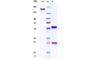 Anti-SIRPa / CD172a Reference Antibody (BI 765063) on SDS-PAGE under reducing (R) condition.