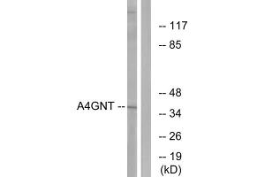 Western blot analysis of extracts from K562 cells, using A4GNT antibody. (A4GNT Antikörper  (Internal Region))