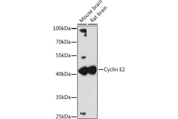 Cyclin E2 Antikörper  (C-Term)