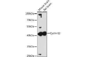 Western blot analysis of extracts of various cell lines, using Cyclin E2 antibody (ABIN1679046, ABIN3018761, ABIN3018762 and ABIN6220571) at 1:3000 dilution. (Cyclin E2 Antikörper  (C-Term))