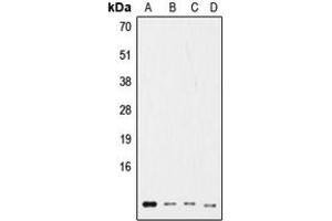 Western blot analysis of Ub expression in HeLa (A), NIH3T3 (B), rat kidney (C), HL60 (D) whole cell lysates. (Ubiquitin Antikörper  (Center))