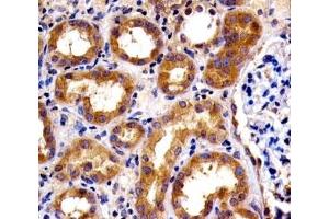 Immunohistochemistry (IHC) image for anti-Sphingosine Kinase 1 (SPHK1) (AA 59-89) antibody (ABIN3032711)