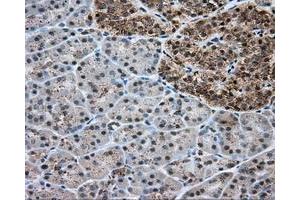 Immunohistochemical staining of paraffin-embedded liver tissue using anti-ERCC1 mouse monoclonal antibody. (ERCC1 Antikörper)