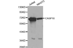 Western blot analysis of extracts of various cell lines, using CASP10 antibody (ABIN5970048) at 1/1000 dilution. (Caspase 10 Antikörper)