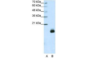 WB Suggested Anti-RPS14  Antibody Titration: 1. (RPS14 Antikörper  (N-Term))