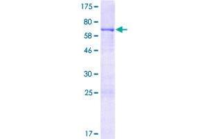 Image no. 1 for Bone Morphogenetic Protein 2 (BMP2) (AA 1-396) protein (GST tag) (ABIN1346750)