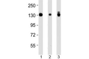 Western blot testing of Integrin alpha 3 antibody at 1:4000 dilution and 1) A431 lysate, 2) HeLa lysate, and 3) PC3 lysate at 1:2000. (ITGA3 Antikörper  (N-Term))