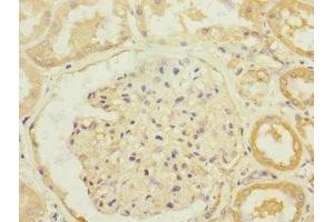 Immunohistochemistry of paraffin-embedded human kidney tissue using ABIN7170096 at dilution of 1:100 (SLC13A2 Antikörper  (AA 345-455))