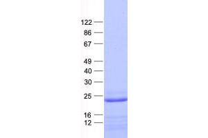 Validation with Western Blot (ASPDH Protein (His tag))
