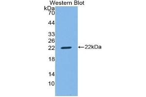 Western blot analysis of the recombinant protein. (CD8B Antikörper  (AA 22-175))