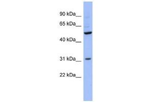 RBMS3 antibody used at 1 ug/ml to detect target protein. (RBMS3 Antikörper  (Middle Region))