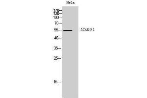 Western Blotting (WB) image for anti-AChR beta 1 (N-Term) antibody (ABIN3173651) (AChR beta 1 (N-Term) Antikörper)