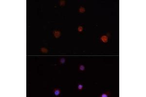Immunofluorescence analysis of THP-1 cells using NLRC4 Polyclonal Antibody (NLRC4 Antikörper)