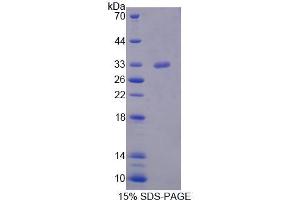 SDS-PAGE analysis of Mouse STK11 Protein.