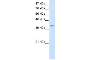 WB Suggested Anti-LMX1A Antibody Titration:  0. (LMX1A Antikörper  (Middle Region))