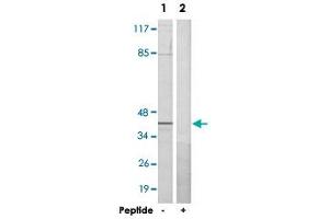 Western blot analysis of extracts from HeLa cells, using RBMX polyclonal antibody . (RBMX Antikörper  (N-Term))
