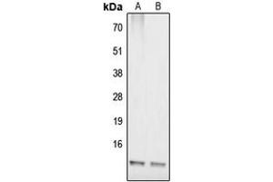 Western blot analysis of COX17 expression in IMR32 (A), HepG2 (B) whole cell lysates. (COX17 Antikörper  (N-Term))