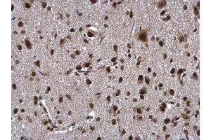 IHC-P Image ZNF346 antibody [N1C3] detects ZNF346 protein at cytoplasm and nucleus in rat brain by immunohistochemical analysis. (ZNF346 Antikörper)