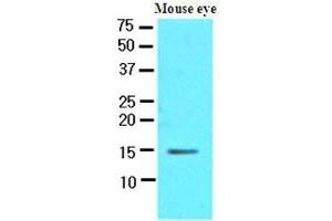 The extracts of mouse eye (30 ug) were resolved by SDS-PAGE, transferred to nitrocellulose membrane and probed with anti-human CRABP1 (1:500).