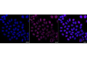 anti-CDK1/2/3 (pThr14) antibody