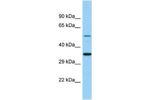 Western Blotting (WB) image for anti-Membrane Bound O-Acyltransferase Domain Containing 4 (MBOAT4) (C-Term) antibody (ABIN2444668) (MBOAT4 Antikörper  (C-Term))