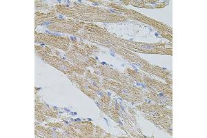 Immunohistochemistry of paraffin-embedded mouse heart using TRP antibody (ABIN6133559, ABIN6149565, ABIN6149567 and ABIN6224668) at dilution of 1:100 (40x lens). (TRPA1 Antikörper  (AA 850-950))